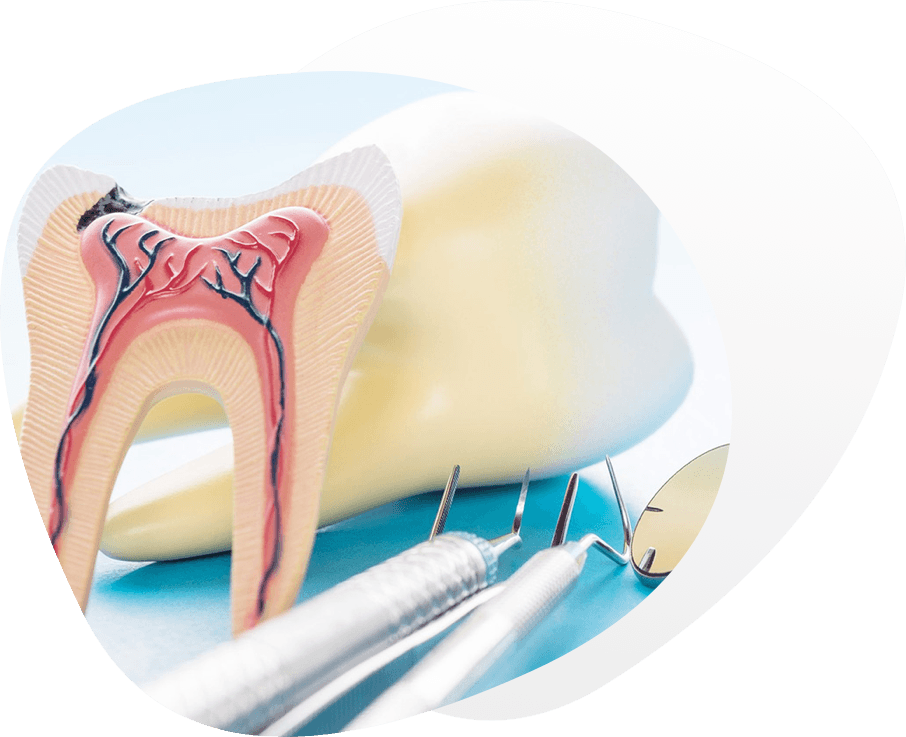 Restaurativa i endodoncija