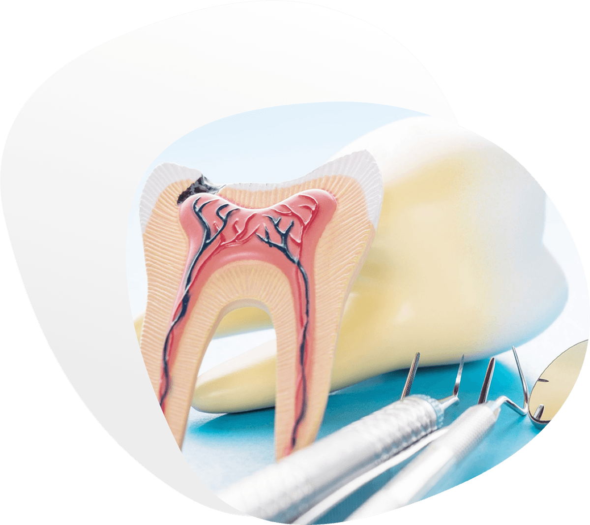 Restaurativa i endodoncija