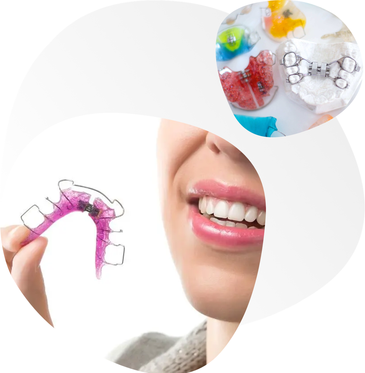 Mobilni aparatić za zube