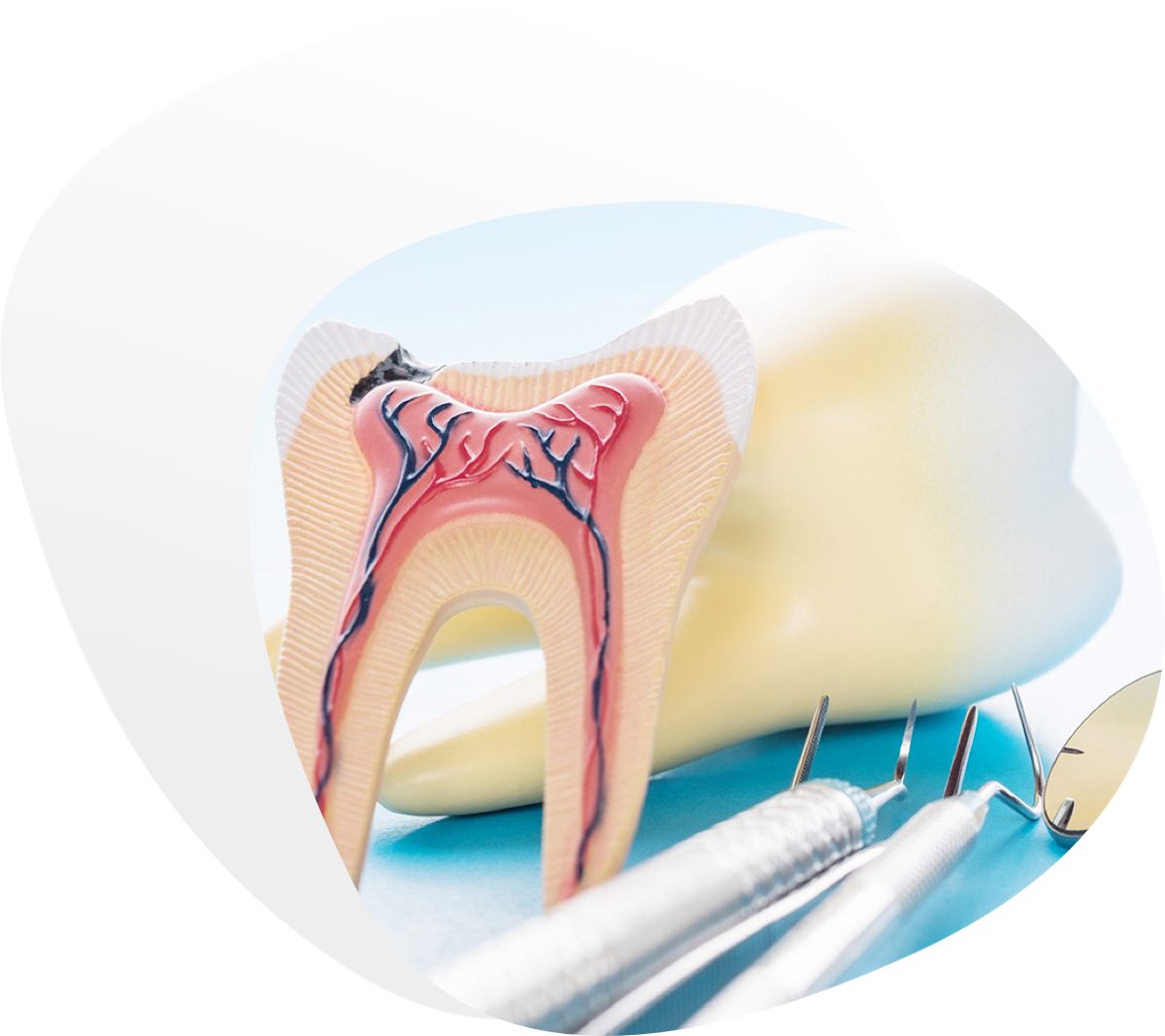 Restaurativa i endodoncija